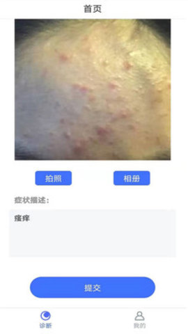 扫一扫识别皮肤病app