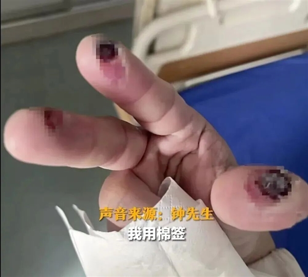 一次意外接触就不幸身亡！国家应急广播：警惕身边这些化学品