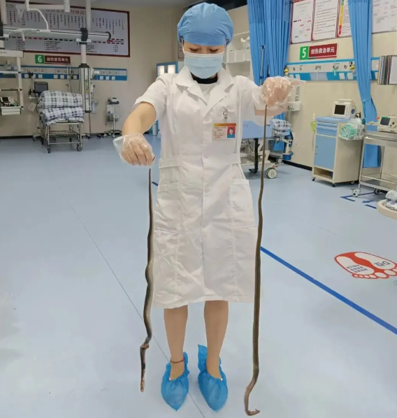 老人被咬后手提2条眼镜蛇进急诊：非常生气当场将蛇打死