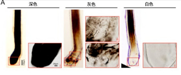 白头发别急着拔！重新变黑发的方法找到了