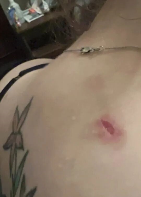 胖有胖的好!美国女子身中7枪奇迹存活:全凭一身脂肪挡子弹