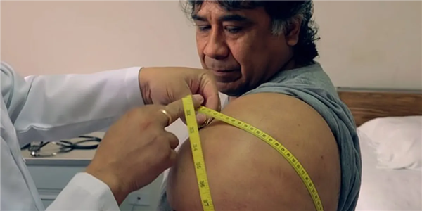 深潜后上升太快 秘鲁潜水员身体肿成大力水手：太痛苦！