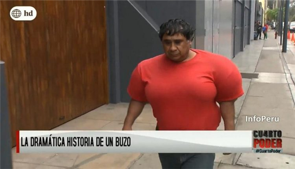 深潜后上升太快 秘鲁潜水员身体肿成大力水手：太痛苦！