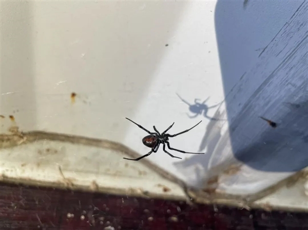 女子被蜘蛛咬后小腿肿成“大象腿” 医生:继发性淋巴水肿