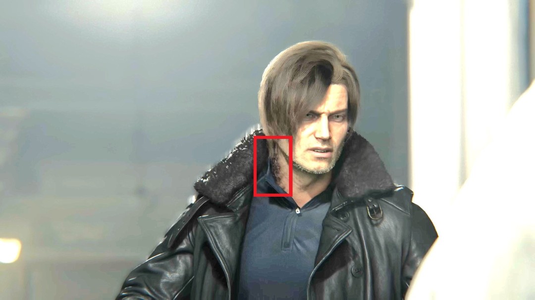 里昂颈部特写显示黑色感染痕迹