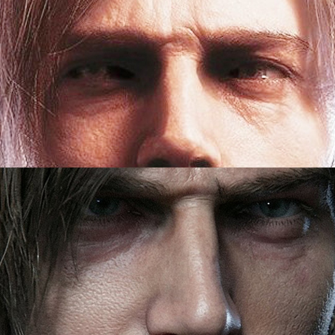 感染者眼部对比