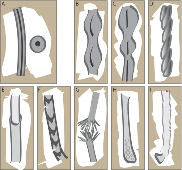 头发开叉其实是种病,很多人忽视了!3步就能改善