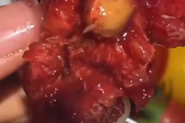 医生称车厘子果蝇的幼虫水洗不掉 需多流程进行清理
