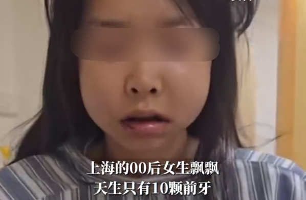 00后女子天生只有10颗前牙：提醒大家爱惜牙齿
