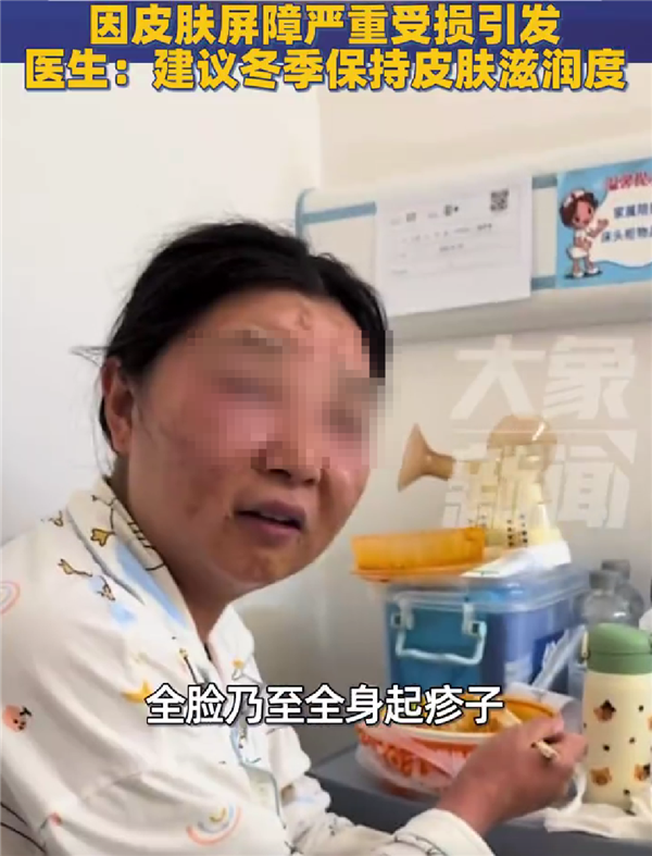 怕孩子被传染流感:新手宝妈频繁洗手致过敏、脸变形