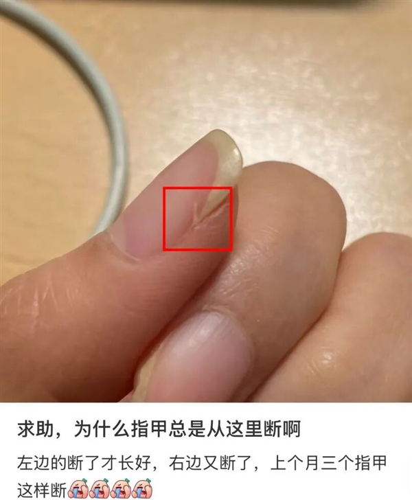 指甲为什么总从这个地方断开 是缺钙了吗